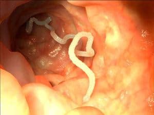 Intestinal tapeworm in dog