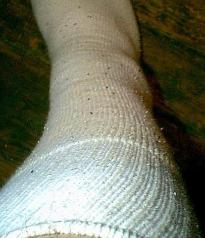 Flea identification little black dots squirming around in fur on socks couch furniture