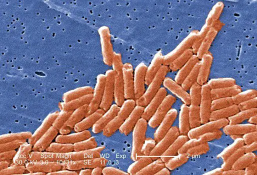 Eggshell consumption dangers salmonella poisoning bacteria debris cuts blockage